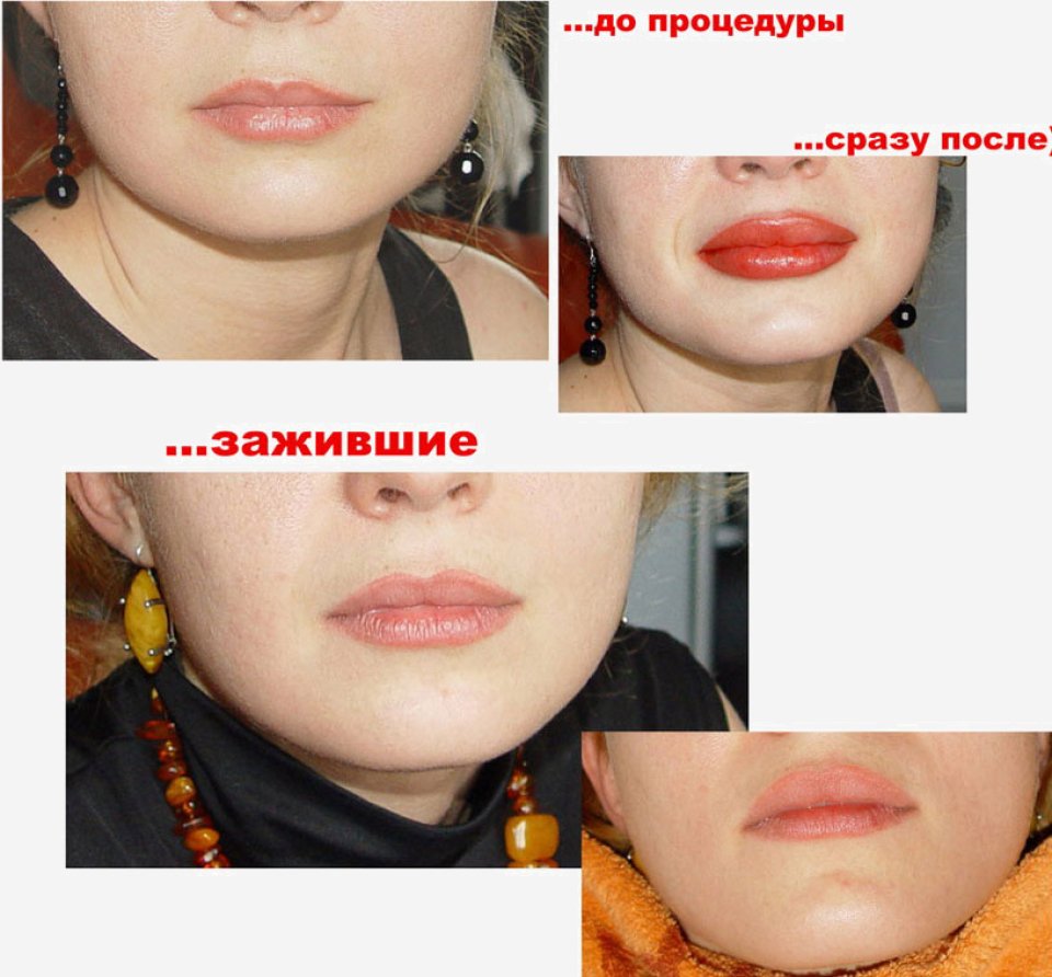 Перманент губ коррекция фото до и после